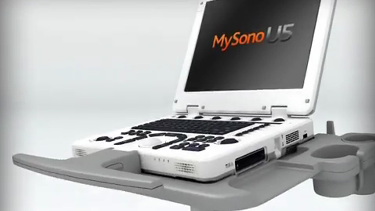 Samsung Medison MySono U5 демо