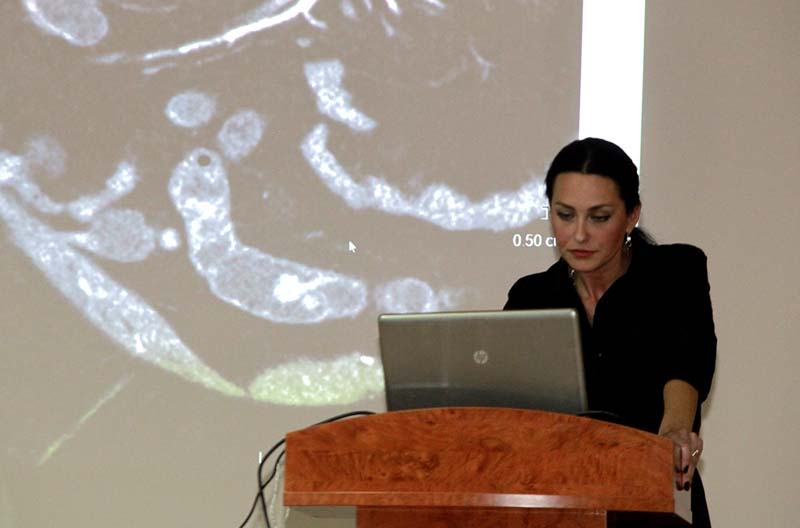 Наталія Мотринець демонструє зображення, отримані під час аплікації комп′ютерного томографа